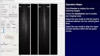 Real-time optical distortion correction and structural parameter measurement for an eye model