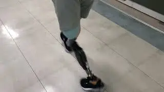 Trying on prosthetic knee joint in Korea