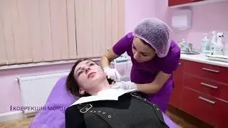 ПЛАЗМОЛИФТИНГ [aristo.studio]
