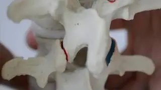 Lumbar Model - Origins of back pain related to hypermobility