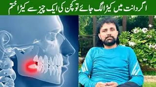 How to naturally treat and prevent tooth cavity | Health Tips