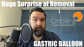 ORBERA - My journey with the BALLOON Procedure - Removal and Huge Surprise