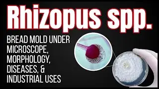 Rhizopus spp. Explained: Bread Mold Under Microscope, Morphology, Diseases, & Industrial Uses