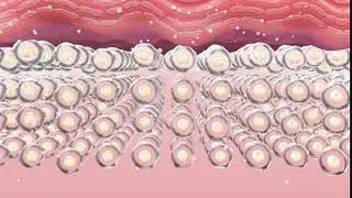Subderma