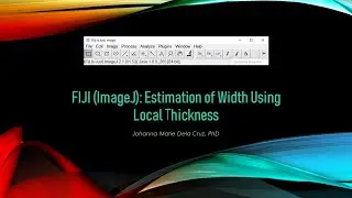 FIJI (ImageJ): Estimation of Width Using Local Thickness