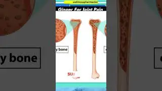 Ginger For Joint Pain #jointpain #ginger #drjavaidkhan #healthtips #health #shorts