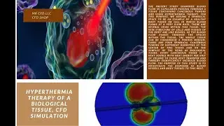 Hyperthermia Therapy of a Biological Tissue CFD Simulation