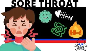 Sore Throat Causes, Laryngitis, Pharyngitis, Tonsillitis, Virus, Bacteria, Traumatic. Animation 4k.