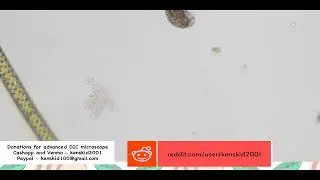 Microscopic creatures.