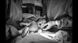 Foto e vídeo  de parto no Hospital e Maternidade Santa Maria