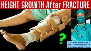 HEIGHT GROWTH After FRACTURE ? फ़्रैक्चर/ हड्डी टूटने के बाद HEIGHT GROWTH होगा ? by Dr Rupal