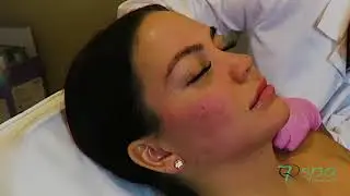7Q Spa Laser & Aesthetics: PDO Thread Contouring