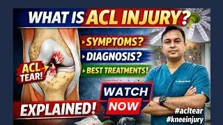 ACL Ligament Tear Explained by Orthopaedic Surgeon | Symptoms, MRI aur Best Treatment !