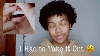 I Had to Take Out My Smiley Piercing !! | *I'm Sad*