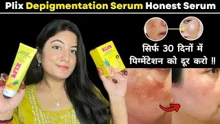 Plix Pineapple De-pigmentation Serum Honest Review || 😱 Clear Pigmentation in 30 Days !! 