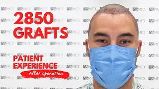 ASMED - Dr. Koray Erdogan - Hair Transplant Experience During the Corona Days #hairtransplantturkey