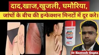 Candid Dusting Powder। Candid Dusting Powder Review। Candid Dusting Powder Use, Benefits.
