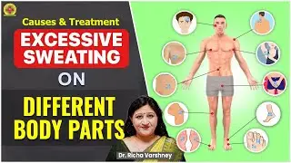 How To Stop Excessive Sweating || Acupressure Points || Dr. Richa Varshney's Free Online Training