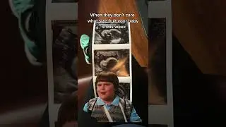 Cantaloupe BTW 🥲 #pregnancymeme #pregnant #pregnancy #pregnancyhumor #secondtrimester #ultrasound