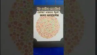 #uppolicemedical