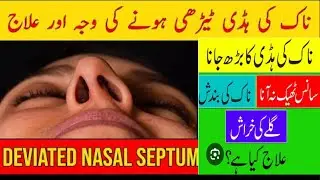 Deviated Nasal Septum Nasal Bone Deviation | Breathing Problems Dr Health Officials 