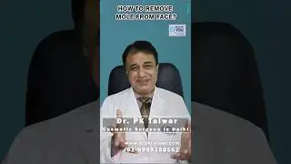 चेहरे से Mole  कैसे हटाएं? Mole Removal Treatment In Delhi | Dr. PK Talwar