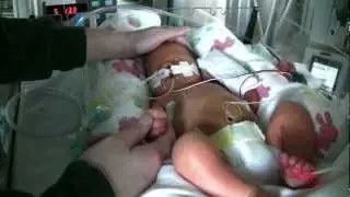 Understanding preterm infant development