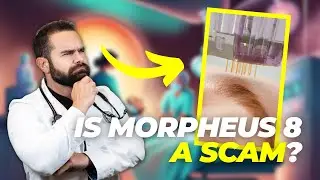 THE TRUTH About Morpheus-8