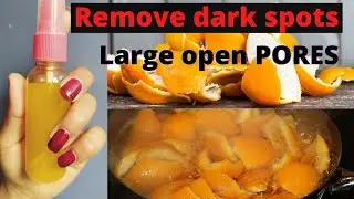 Orange Peel Toner DIY | Spray This Water Every Night on Face & Wake up PORELESS Tight Glowing Skin