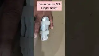 Finger Splint #Conservative Management -Xray - Middle Phalanx of Ring Finger fracture hand#Bone pain