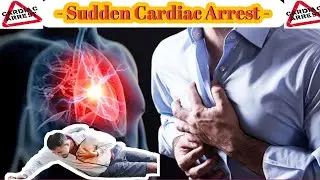 Sudden Cardiac Arrest reason - Animation | Why it's Happen😢 | #cardiacarrest #heartattack