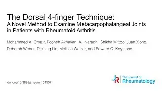 The Dorsal 4-finger Technique