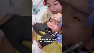 Munel cabut gigi #cabutgigi #doktergigianak