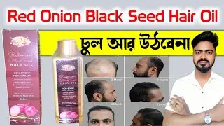 RED ONION BLACK SEED HAIR OIL REVIEW IN BANGLA | RED ONION HAIR OIL | BONG MEDICINE