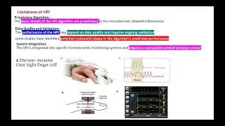 3 OCT 2025 HYPOTENSION PREDICTION INDEX AND ADVANCED HEMODYNAMIC MONITORING - PROFESSOR V NAGASWAMY