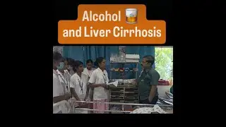 #drabhishekshukla #livercirrhosis #ascites #chronicliverdisease #hepatitisc #fattyliver #alcohol