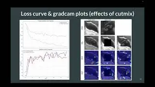 Medical Ultrasound Image Classification Using SSM Models