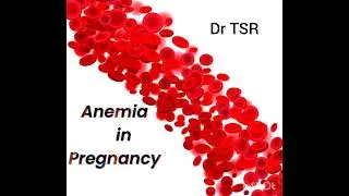 #mock case #anemia 