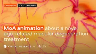 CASE STUDY. UBX1325 MoA in Age-related Macular Degeneration for Unity Biotechnology (NAS: UBX)