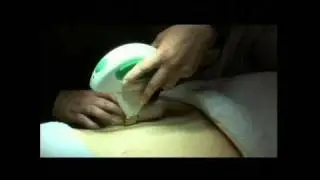 Clinic Lémanic - Vergetures