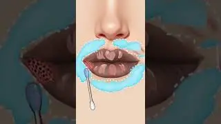lips treatment|HIT BIT #games #gameplay #asmr