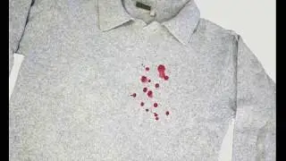Bloedvlekken en andere vlekken verwijderen uit kleding met HG vlekweg
