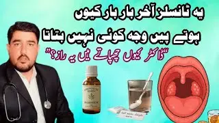 tonsils ka jad se khatma | Real Treatment of Tonsils | Gla dard ka asli ilaj!
