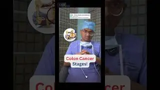 Colon Cancer Stages Explained: What Each Stage Really Means | Dr. Praveen Kammar