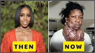 10 Black Celebs With The WORST Plastic Surgery | Then and Now 2026