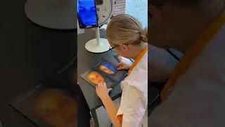 Huidscan bij De Huidkliniek