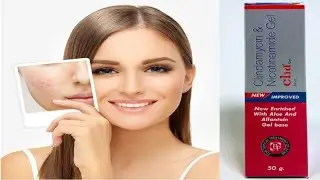 Clid Gel | Pimple and acne treatment | Full description | by Shreshth jain @MedicationHub
