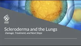 2022 Scleroderma and the Lungs - Dr. Daniel Seifer and Dr. Jeffrey Robinson