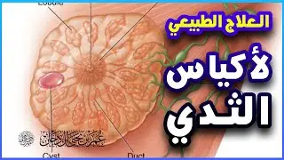 وصفة طبيعية يقترحها الدكتور عمر بن يحيى آل دخان لصحة الثدي ووقايته من الكتل التي قد تتطور إلى سرطان