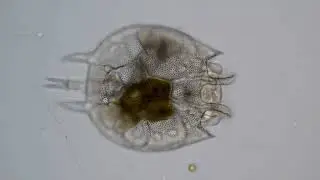 Коловратка из семейства Brachionidae